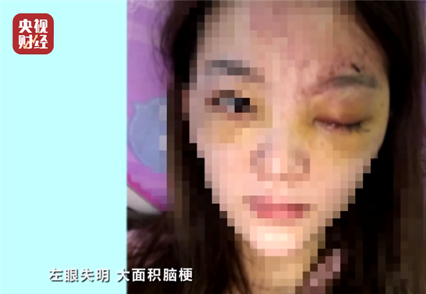 央视315晚会揭秘非法医美速成班：玻尿酸打出大面积脑梗