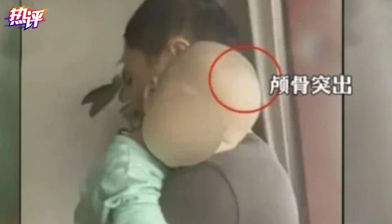 央视热评：又见"大头娃娃"？折断祖国"花朵"就是犯罪